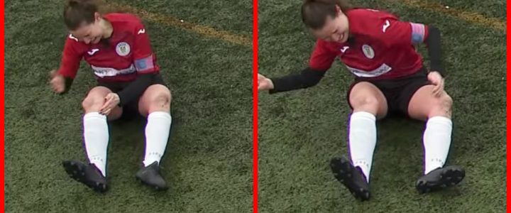 ¡Qué dolor! Futbolista se dislocó la rodilla y se la “acomodó” a puños