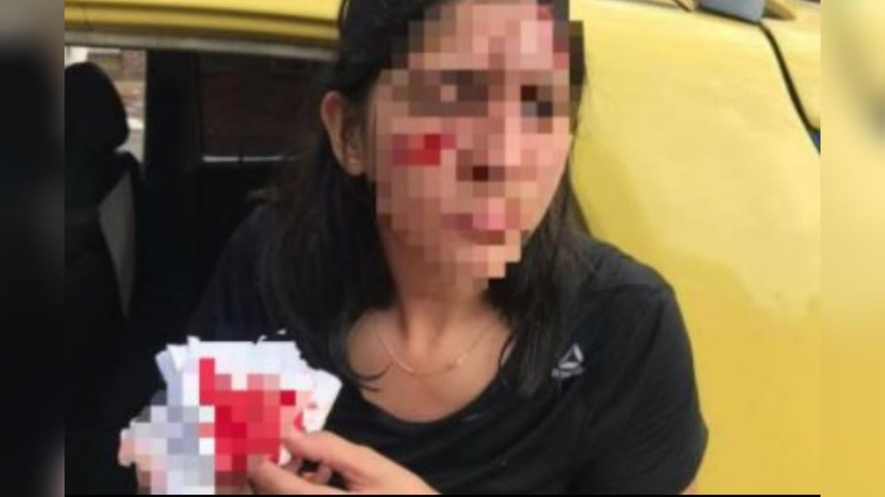 Mujer recibió un fuerte botellazo en su rostro por rechazar un 'piropo'